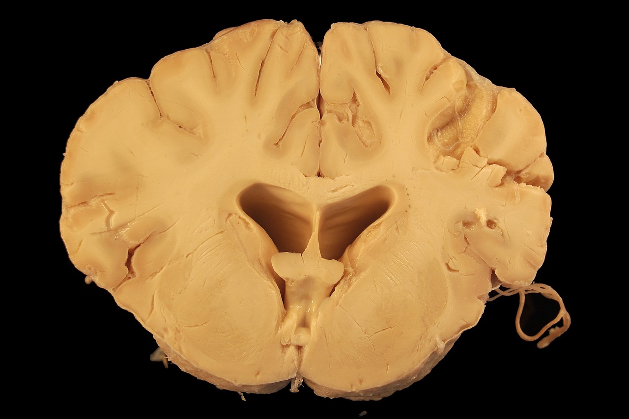 Where Does Consciousness Reside in the Brain?